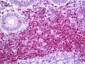 BCL2 / Bcl-2 Antibody (clone 11C5)